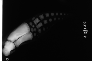 Ein Röntgenbild eines menschlichen Beins mit einem sichtbaren Bruch im Knöchel, mit Text auf der rechten Seite vor einem schwarzen Hintergrund.